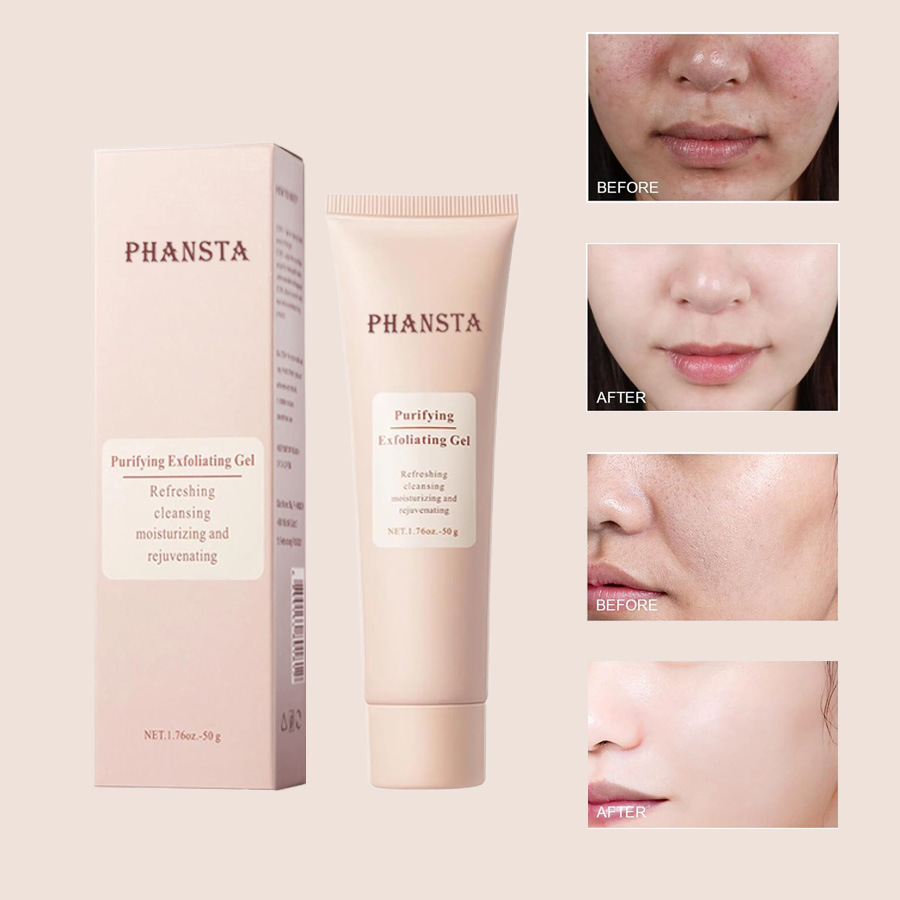 Radiant Skin Exfoliating Gel