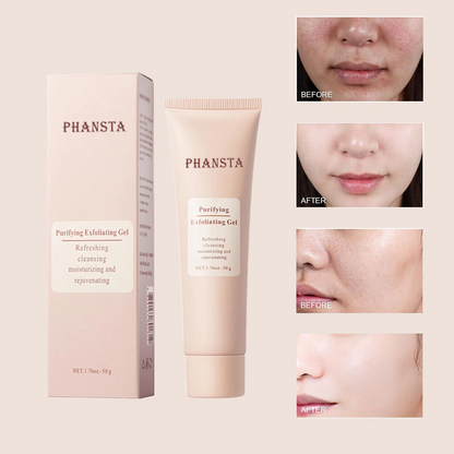 Radiant Skin Exfoliating Gel